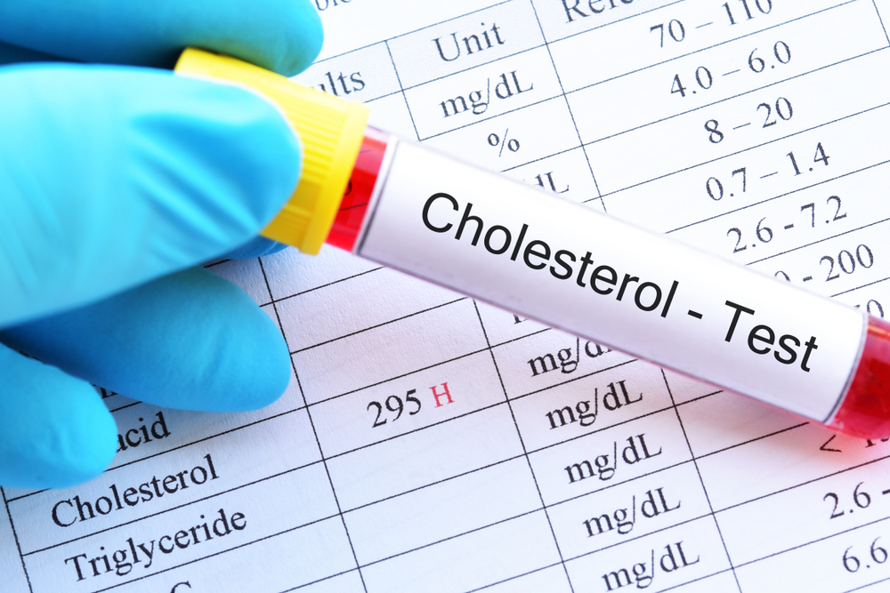 cholesterol test price
