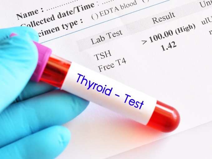 Thyroid test
