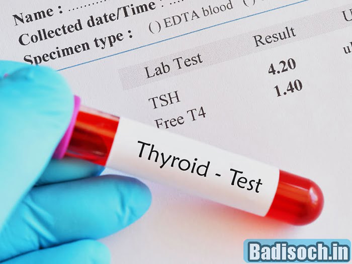 Thyroid Test कैसे चेक करें