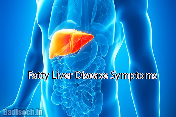 Fatty Liver Disease Symptoms